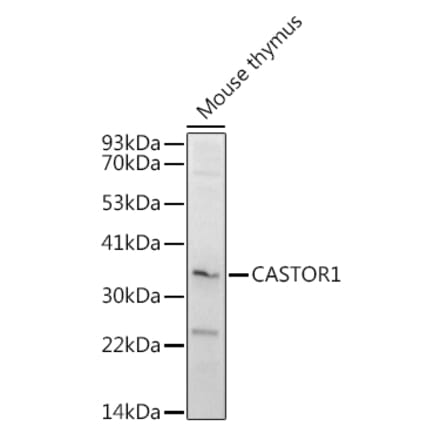 Western Blot - Anti-LOC652968 Antibody (A307249) - Antibodies.com