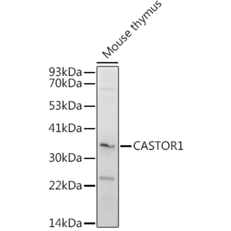 Western Blot - Anti-LOC652968 Antibody (A307249) - Antibodies.com