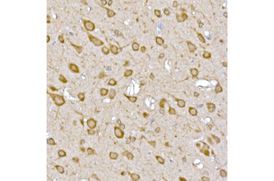 Immunohistochemistry - Anti-LOC652968 Antibody (A307249) - Antibodies.com