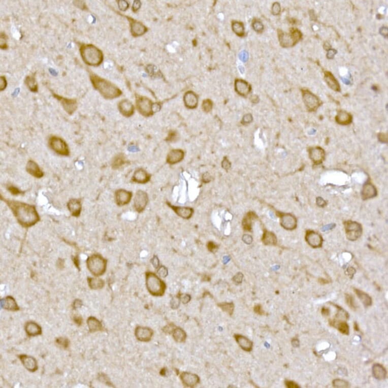 Immunohistochemistry - Anti-LOC652968 Antibody (A307249) - Antibodies.com