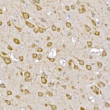 Immunohistochemistry - Anti-LOC652968 Antibody (A307249) - Antibodies.com