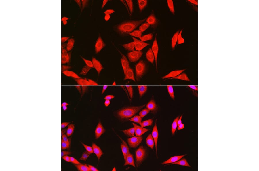 Immunofluorescence - Anti-LOC652968 Antibody (A307249) - Antibodies.com