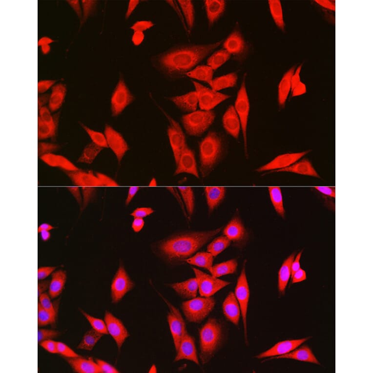 Immunofluorescence - Anti-LOC652968 Antibody (A307249) - Antibodies.com
