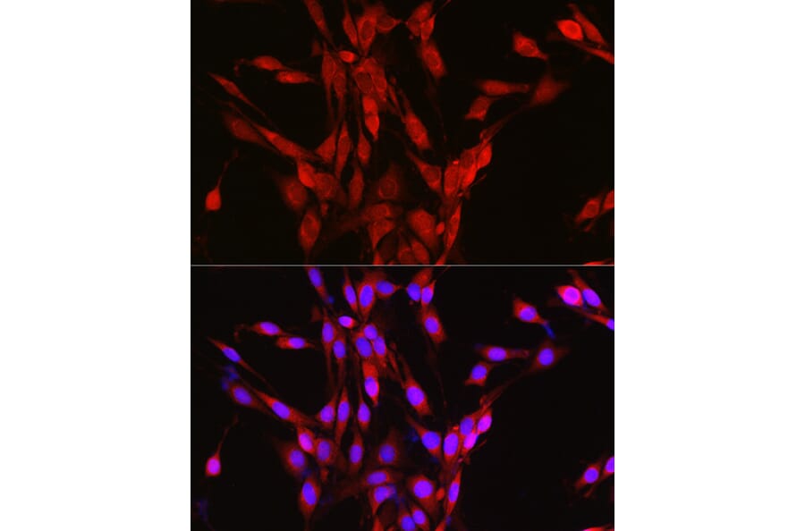 Immunofluorescence - Anti-LOC652968 Antibody (A307249) - Antibodies.com