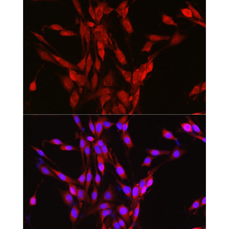 Immunofluorescence - Anti-LOC652968 Antibody (A307249) - Antibodies.com