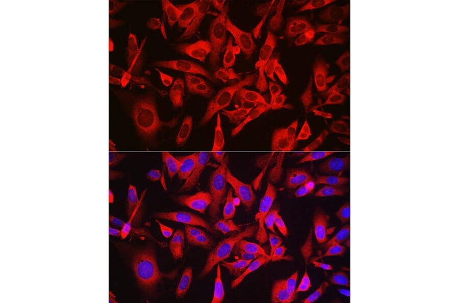 Immunofluorescence - Anti-LOC652968 Antibody (A307249) - Antibodies.com