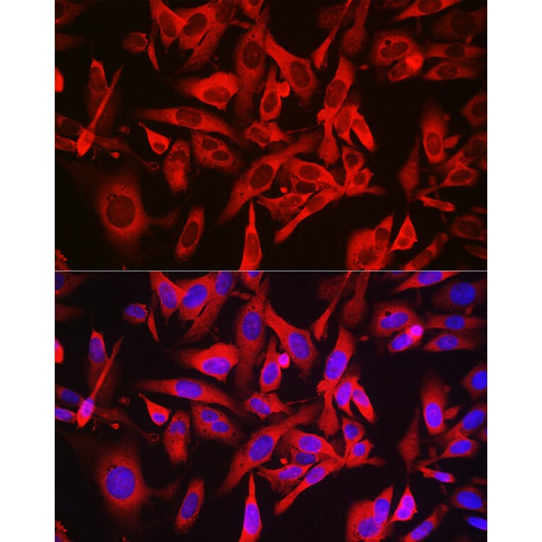 Immunofluorescence - Anti-LOC652968 Antibody (A307249) - Antibodies.com