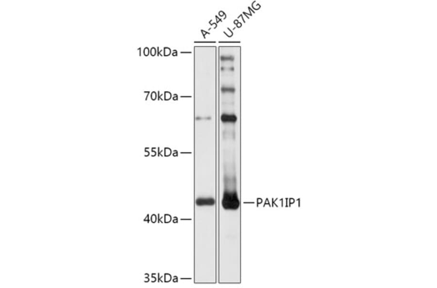Western Blot - Anti-PAK1IP1 Antibody (A307251) - Antibodies.com