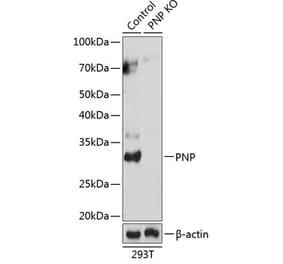 Western Blot - Anti-Nucleoside phosphorylase Antibody (A307253) - Antibodies.com