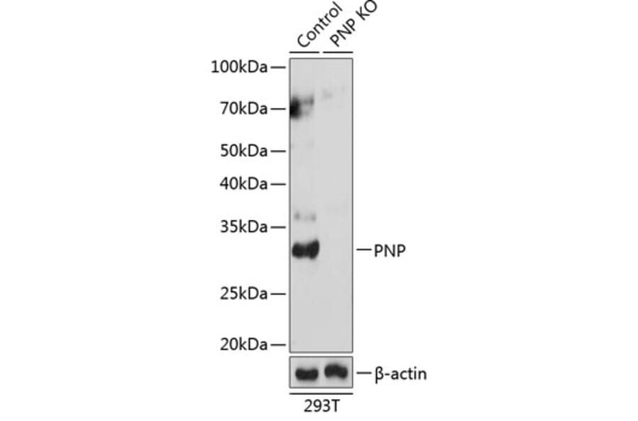 Western Blot - Anti-Nucleoside phosphorylase Antibody (A307253) - Antibodies.com