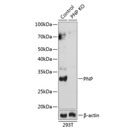 Western Blot - Anti-Nucleoside phosphorylase Antibody (A307253) - Antibodies.com