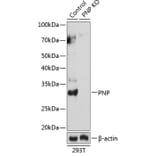 Western Blot - Anti-Nucleoside phosphorylase Antibody (A307253) - Antibodies.com
