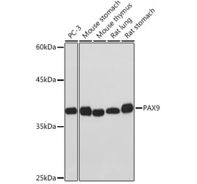 Western Blot - Anti-PAX9 Antibody [ARC2267] (A307255) - Antibodies.com