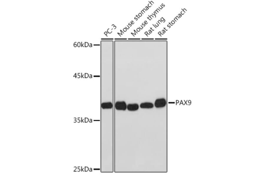 Western Blot - Anti-PAX9 Antibody [ARC2267] (A307255) - Antibodies.com