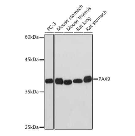 Western Blot - Anti-PAX9 Antibody [ARC2267] (A307255) - Antibodies.com