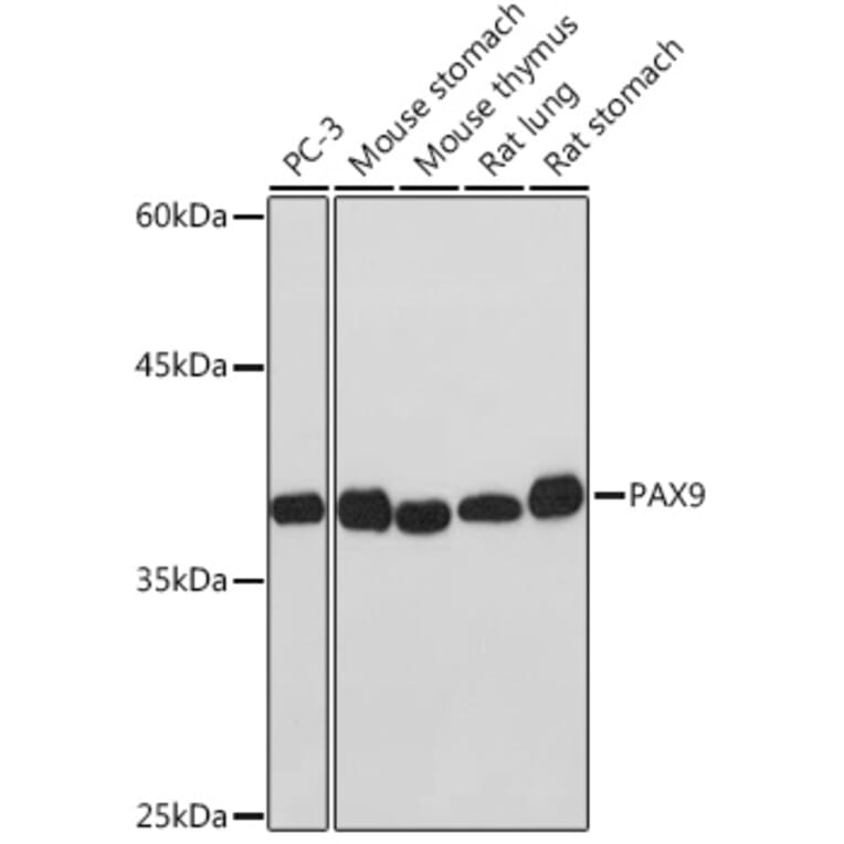 Western Blot - Anti-PAX9 Antibody [ARC2267] (A307255) - Antibodies.com