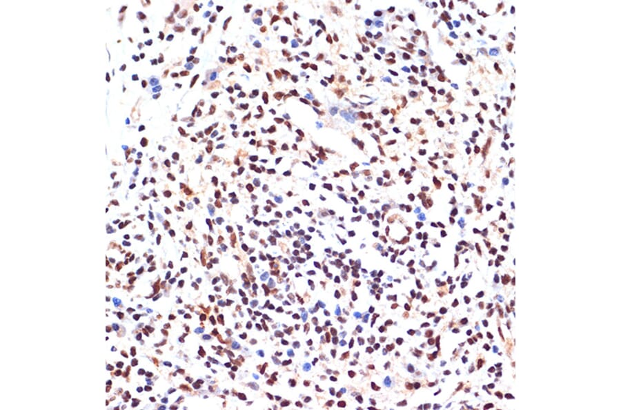 Immunohistochemistry - Anti-PAX9 Antibody [ARC2267] (A307255) - Antibodies.com