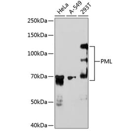 Western Blot - Anti-PML Protein Antibody [ARC0125] (A307256) - Antibodies.com