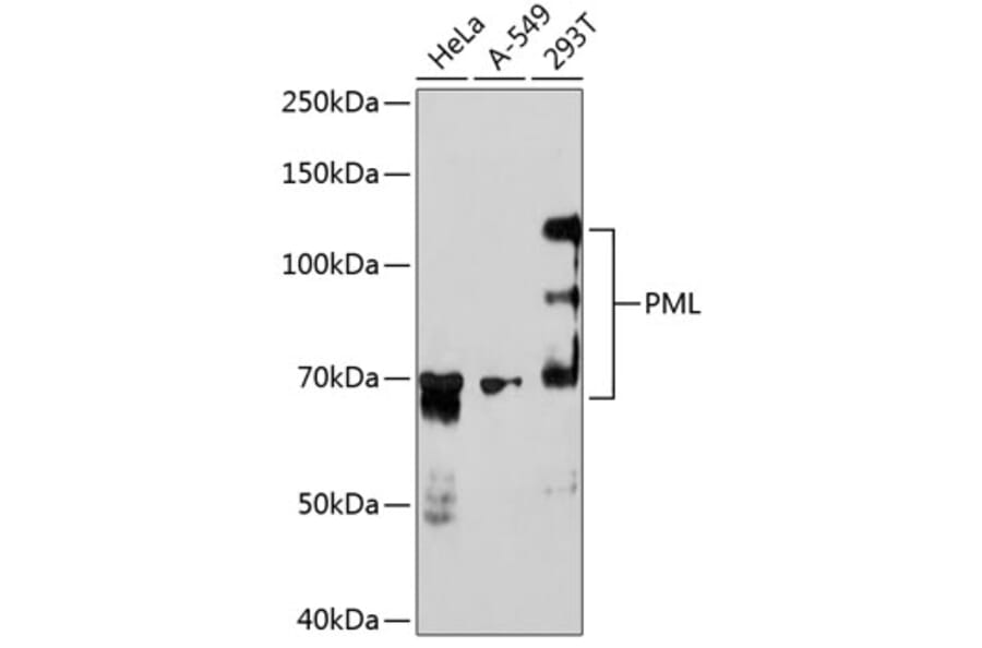 Western Blot - Anti-PML Protein Antibody [ARC0125] (A307256) - Antibodies.com