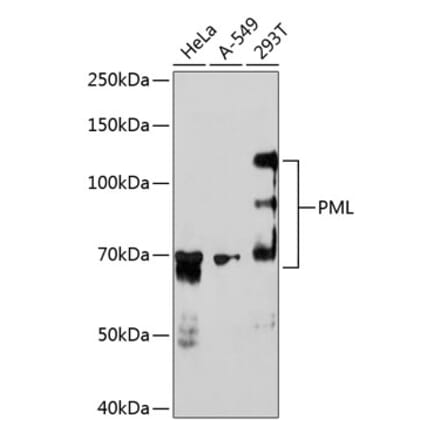Western Blot - Anti-PML Protein Antibody [ARC0125] (A307256) - Antibodies.com