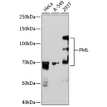 Western Blot - Anti-PML Protein Antibody [ARC0125] (A307256) - Antibodies.com