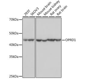 Western Blot - Anti-Delta Opioid Receptor Antibody [ARC1786] (A307257) - Antibodies.com