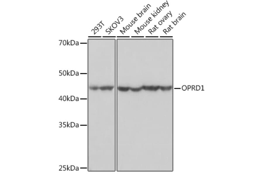 Western Blot - Anti-Delta Opioid Receptor Antibody [ARC1786] (A307257) - Antibodies.com