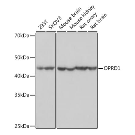 Western Blot - Anti-Delta Opioid Receptor Antibody [ARC1786] (A307257) - Antibodies.com