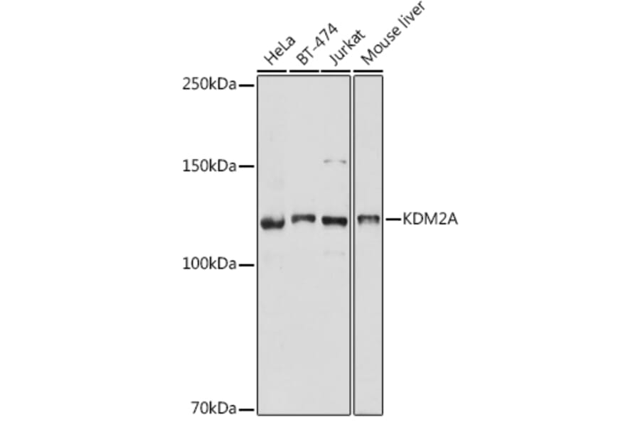 Western Blot - Anti-KDM2A Antibody (A307258) - Antibodies.com