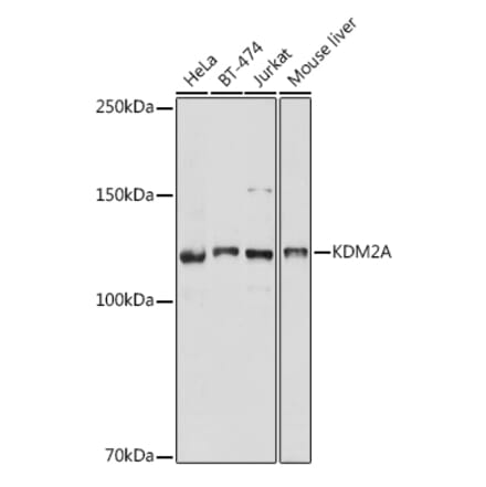 Western Blot - Anti-KDM2A Antibody (A307258) - Antibodies.com