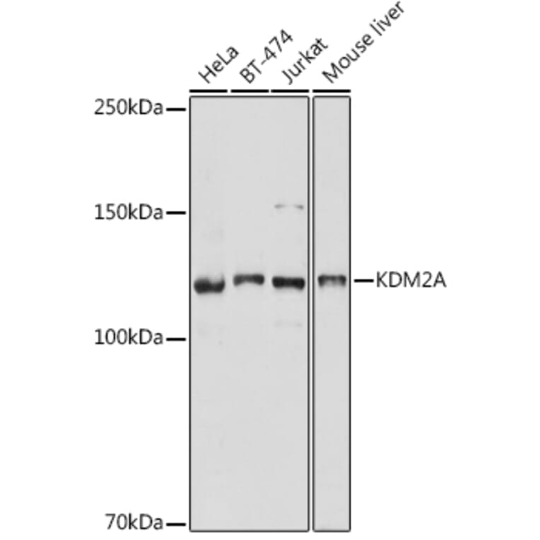 Western Blot - Anti-KDM2A Antibody (A307258) - Antibodies.com