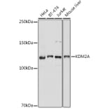 Western Blot - Anti-KDM2A Antibody (A307258) - Antibodies.com