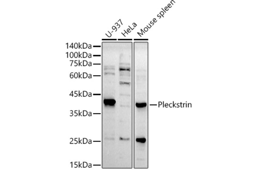Western Blot - Anti-Pleckstrin Antibody [ARC2870] (A307260) - Antibodies.com