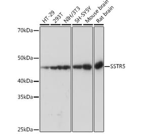 Western Blot - Anti-Somatostatin Receptor 5 Antibody [ARC1282] (A307261) - Antibodies.com