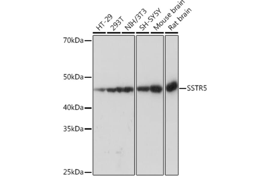 Western Blot - Anti-Somatostatin Receptor 5 Antibody [ARC1282] (A307261) - Antibodies.com