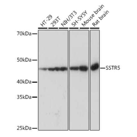 Western Blot - Anti-Somatostatin Receptor 5 Antibody [ARC1282] (A307261) - Antibodies.com