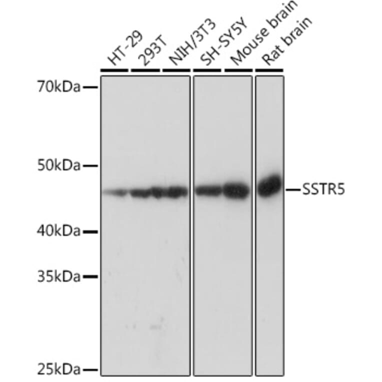 Western Blot - Anti-Somatostatin Receptor 5 Antibody [ARC1282] (A307261) - Antibodies.com