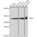 Western Blot - Anti-Somatostatin Receptor 5 Antibody [ARC1282] (A307261) - Antibodies.com