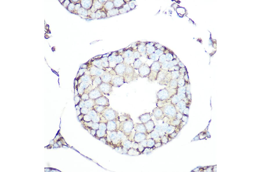Immunohistochemistry - Anti-Somatostatin Receptor 5 Antibody [ARC1282] (A307261) - Antibodies.com