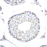 Immunohistochemistry - Anti-Somatostatin Receptor 5 Antibody [ARC1282] (A307261) - Antibodies.com