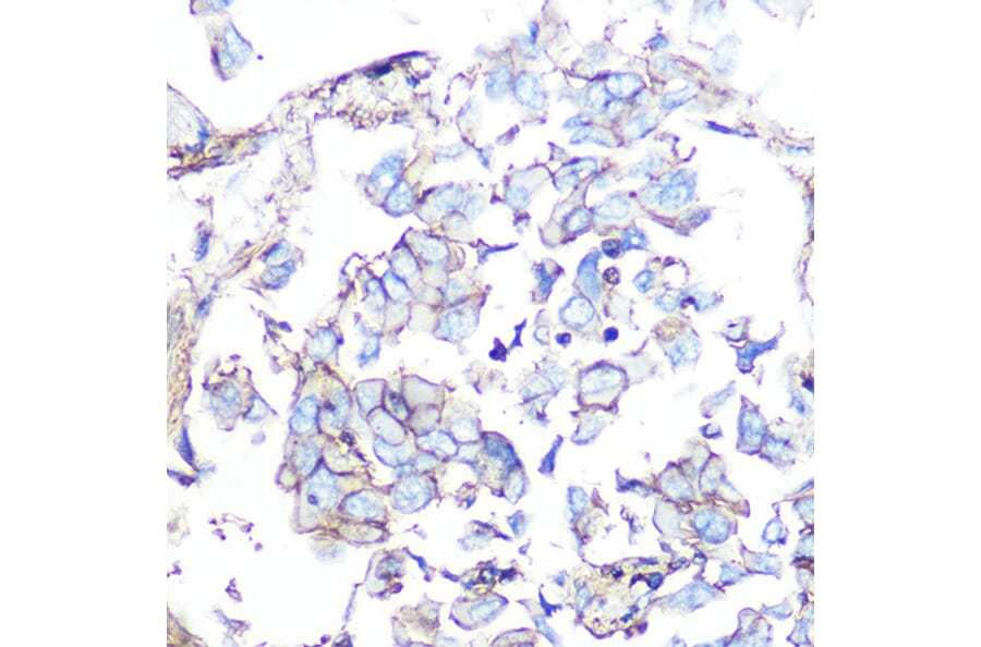 Immunohistochemistry - Anti-Somatostatin Receptor 5 Antibody [ARC1282] (A307261) - Antibodies.com