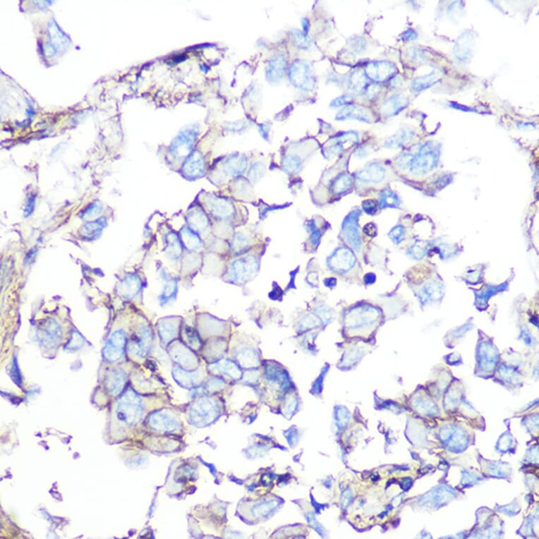 Immunohistochemistry - Anti-Somatostatin Receptor 5 Antibody [ARC1282] (A307261) - Antibodies.com