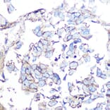 Immunohistochemistry - Anti-Somatostatin Receptor 5 Antibody [ARC1282] (A307261) - Antibodies.com