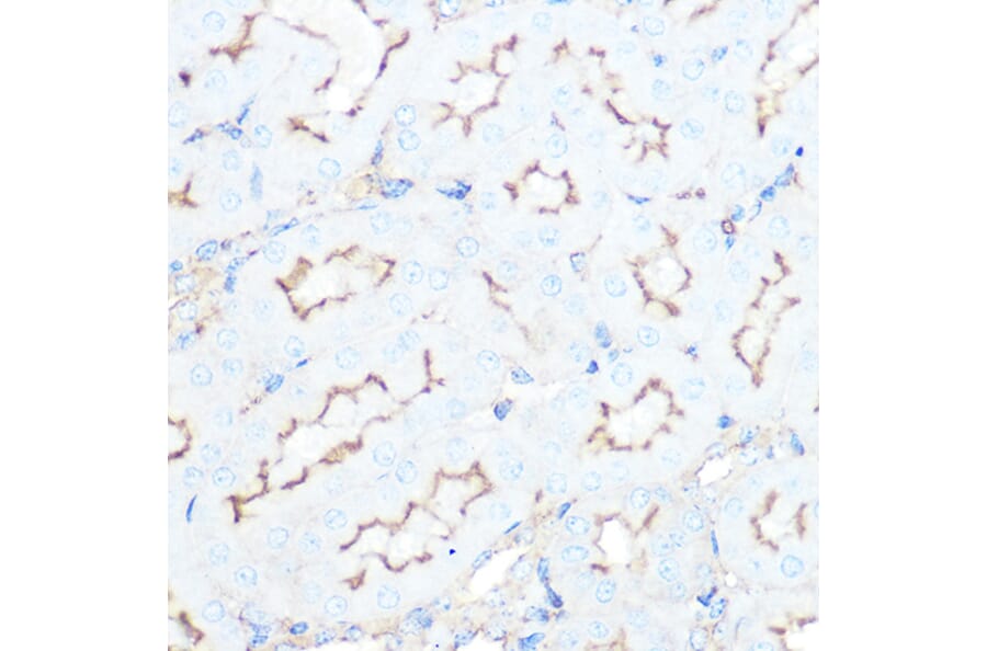 Immunohistochemistry - Anti-Somatostatin Receptor 5 Antibody [ARC1282] (A307261) - Antibodies.com