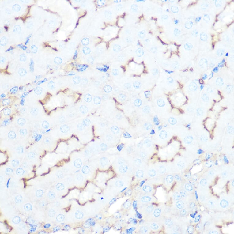 Immunohistochemistry - Anti-Somatostatin Receptor 5 Antibody [ARC1282] (A307261) - Antibodies.com