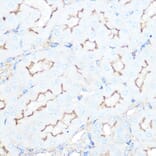 Immunohistochemistry - Anti-Somatostatin Receptor 5 Antibody [ARC1282] (A307261) - Antibodies.com