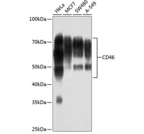 Western Blot - Anti-CD46 Antibody [ARC0428] (A307262) - Antibodies.com