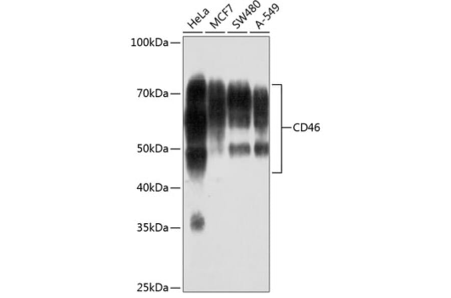 Western Blot - Anti-CD46 Antibody [ARC0428] (A307262) - Antibodies.com