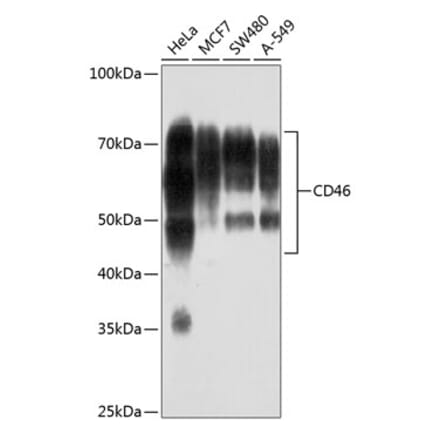 Western Blot - Anti-CD46 Antibody [ARC0428] (A307262) - Antibodies.com