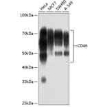 Western Blot - Anti-CD46 Antibody [ARC0428] (A307262) - Antibodies.com